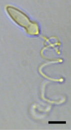 A light micrograph of a bullet-shaped cell with a large spiral filament (the extruded nematocyst).