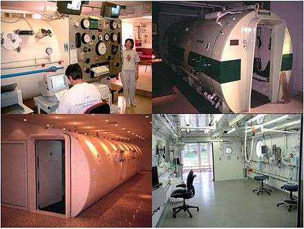 Collage of 4 images of multiplace hyperbaric chambers