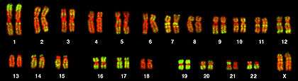 A microscopy image of 46 chromosomes striped with red and green bands