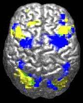 A human brain viewed from above. About 10% is highlighted in yellow and 10% in blue. There is only a tiny (perhaps 0.5%) green region where they overlap.