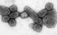 An electron micrograph of the virus that caused Spanish influenza
